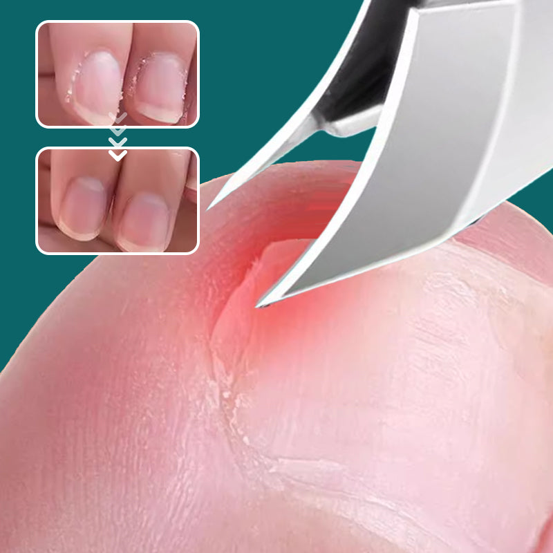 Cortaúñas antisalpicaduras con borde inclinado de 25° (juego de 3 piezas)