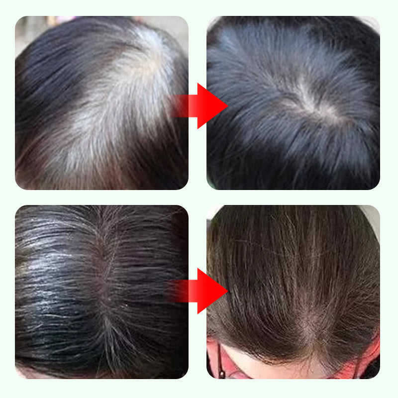 💆‍♀️✨ Lápiz Cubrecanas de Acción Instantánea - Cobertura Natural en 10 Segundos con Fórmula Resistente al Agua para un Look Juvenil 🌟✏️