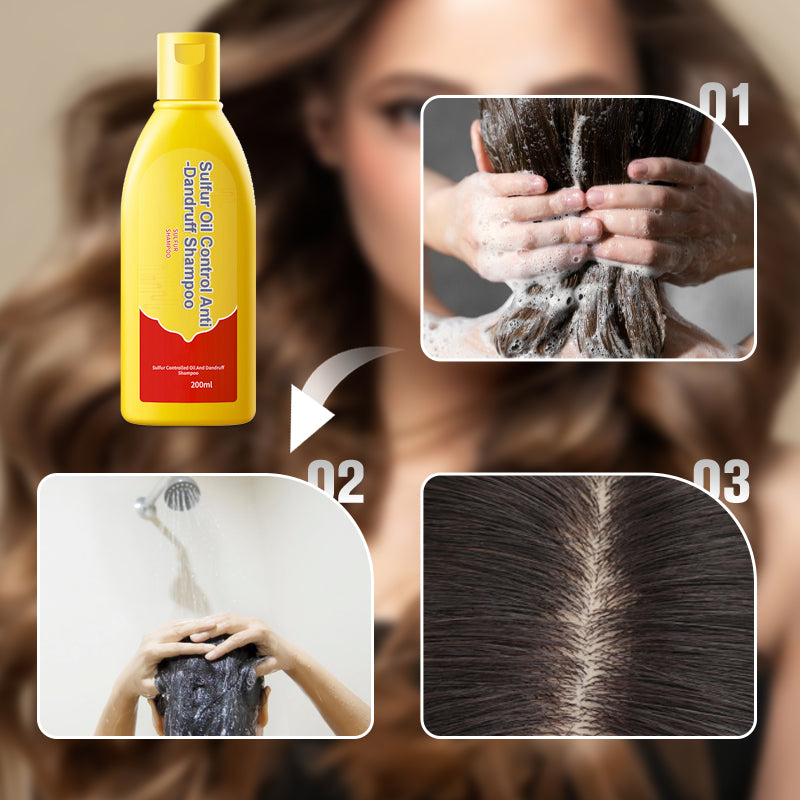 Shampoo de Azufre Control de Grasa y Anticaspa