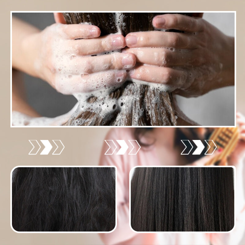Shampoo de Azufre Control de Grasa y Anticaspa