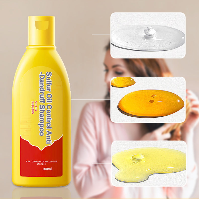 Shampoo de Azufre Control de Grasa y Anticaspa