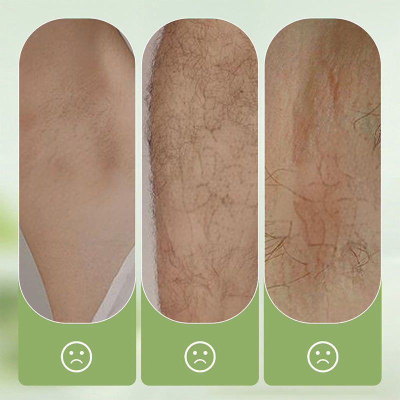 ⏰🔥 ¡Oferta Limitada 50% OFF! ✨ Crema Depilatoria Suave y No Irritante – Piel Suave y Libre de Vello en Minutos 🧴💖