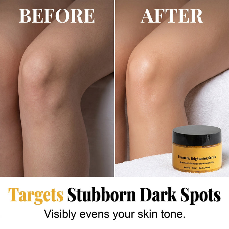 🔥 Exfoliante Corporal de Cúrcuma